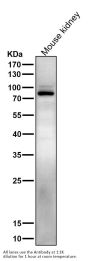 Anti-Phospho-Stat5 (Y694) STAT5A Rabbit Monoclonal Antibody