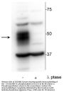 Anti-Phospho-MEF2C (Ser222) Antibody