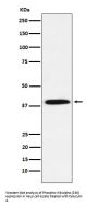 Anti-Phospho-IKB alpha (S36) Rabbit Monoclonal Antibody