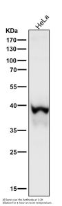 Anti-Phospho-IKB alpha (S36) Rabbit Monoclonal Antibody