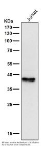 Anti-Phospho-IKB alpha (S32) NFKBIA Rabbit Monoclonal Antibody