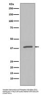 Anti-Phospho-IKB alpha (S32) NFKBIA Rabbit Monoclonal Antibody