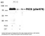 Anti-Phospho-PKCth (Ser676) PRKCQ Antibody