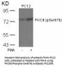 Anti-Phospho-PKCth (Ser676) PRKCQ Antibody