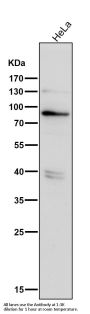 Anti-Phospho-PKR (T446) EIF2AK2 Rabbit Monoclonal Antibody