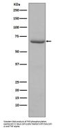 Anti-Phospho-PKR (T446) EIF2AK2 Rabbit Monoclonal Antibody