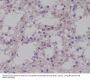 Anti-Phospho-TrkB (Y817) NTRK2 Rabbit Monoclonal Antibody