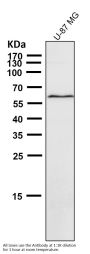 Anti-Phospho-AMPK alpha 2 (S491) PRKAA2 Rabbit Monoclonal Antibody