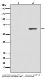 Anti-Phospho-AMPK alpha 2 (S491) PRKAA2 Rabbit Monoclonal Antibody