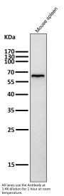 Anti-Phospho-AMPK alpha (T172) PRKAA2 Rabbit Monoclonal Antibody
