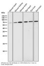 Anti-Phospho-AMPK alpha 2 (S345) PRKAA2 Rabbit Monoclonal Antibody