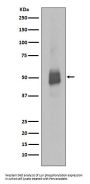Anti-Phospho-Lyn (Y396) Rabbit Monoclonal Antibody