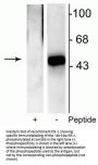 Anti-Phospho-Elk-1 (Ser383) Antibody