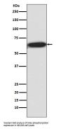 Anti-Phospho-S6K1 (T421 + S424) RPS6KB1 Rabbit Monoclonal Antibody