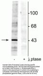 Anti-Phospho-EphrinB (Tyr298) Antibody