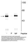 Anti-Phospho-Tryptophan Hydroxylase (Ser260) Antibody