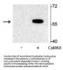 Anti-Phospho-Tryptophan Hydroxylase 2 (Ser19) TPH2 Antibody