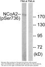 Anti-Phospho NCoA2 (Ser736) Antibody