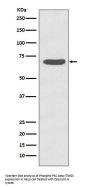 Anti-Phospho-PKC zeta (T560) PRKCZ Rabbit Monoclonal Antibody