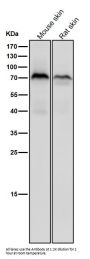 Anti-Phospho-PKC zeta (T560) PRKCZ Rabbit Monoclonal Antibody