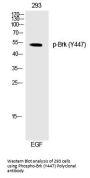 Anti-Phospho-Brk (Tyr447) Polyclonal Antibody