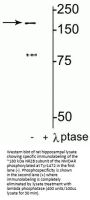 Anti-Phospho-NMDA Receptor NR2B Subunit (Tyr1472) Grin2b Antibody