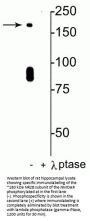 Anti-Phospho-NMDA Receptor NR2B Subunit (Ser1480) Grin2b Antibody