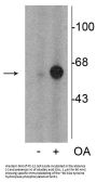 Anti-Phospho-Tyrosine Hydroxylase (Ser31) Antibody