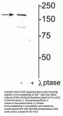 Anti-Phospho-NMDA Receptor NR2A Subunit (Tyr1325) GRIN2A Antibody