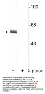 Anti-Phospho-Synaptotagmin (Thr202) Syt1 Antibody