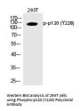 Anti-Phospho-p120 (Tyr228) Polyclonal Antibody