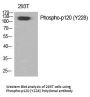 Anti-Phospho-p120 (Tyr228) Polyclonal Antibody