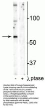 Anti-Phospho-Munc18-1 (Ser241) STXBP1 Antibody