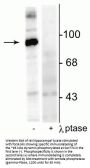 Anti-Phospho-Dynamin (Ser774) Dnm1 Antibody