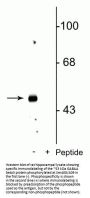 Anti-Phospho-GABAA Receptor beta3 (Ser408/409) Antibody