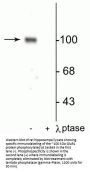 Anti-Phospho-GluR1 (Ser845) Gria1 Antibody