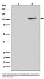 Anti-Phospho-GluR1 (S845) GRIA1 Rabbit Monoclonal Antibody