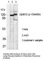 Anti-Phospho-EphB1/2 (Tyr594/604) Antibody