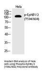 Anti-Phospho-EphB1/2 (Tyr594/604) Antibody