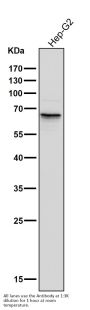 Anti-Phospho-PAK1/2/3 (S144+S141+S139) PAK3 Rabbit Monoclonal Antibody