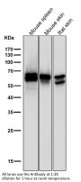 Anti-Phospho-PAK1/2/3 (S144+S141+S139) PAK3 Rabbit Monoclonal Antibody