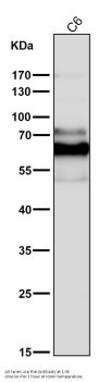 Anti-Phospho-PAK1/2/3 (S144+S141+S139) PAK3 Rabbit Monoclonal Antibody