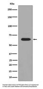 Anti-Phospho-PAK1/2/3 (S144+S141+S139) PAK3 Rabbit Monoclonal Antibody