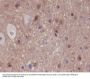 Anti-Phospho-PAK1/2/3 (S144+S141+S139) PAK3 Rabbit Monoclonal Antibody