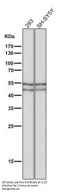 Anti-Phospho-GSK3 (alpha + beta) (Y216 + Y279) GSK3A Rabbit Monoclonal Antibody