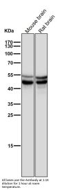 Anti-Phospho-GSK3 (alpha + beta) (Y216 + Y279) GSK3A Rabbit Monoclonal Antibody