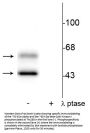 Anti-Phospho-CaM Kinase II (Thr286) Camk2a Antibody