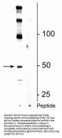 Anti-Phospho-eEF1A2 (Ser358) Antibody