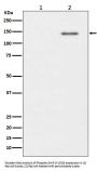 Anti-Phospho-SHIP (Y1020) INPP5D Rabbit Monoclonal Antibody