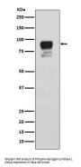 Anti-Phospho-Glycogen synthase 1 (S641) GYS1 Rabbit Monoclonal Antibody